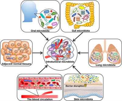 Intratumor microbiota in cancer pathogenesis and immunity: from mechanisms of action to therapeutic opportunities